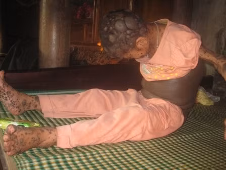 Mang bệnh lạ, em bị gán ghép cái tên 