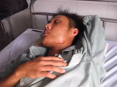 Một nạn nhân bị băng nhóm Dũng Phương đánh phải nhập viện. Một nạn nhân bị băng nhóm Dũng Phương đánh phải nhập viện