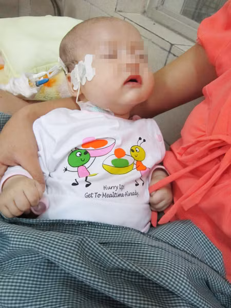 Một bệnh nhi nhiễm độc chì được điều trị tại BV Nhi T.Ư Ảnh: Nguyễn Hoài