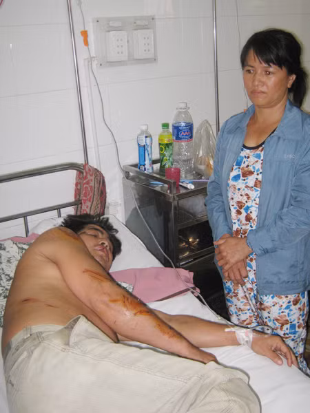 Ông Cẩm bị đa chấn thương do xe máy tông. Ông Cẩm bị đa chấn thương do xe máy tông