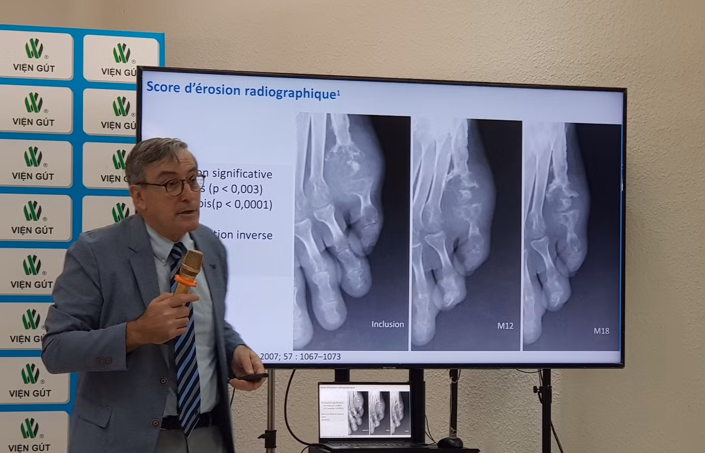 GS Thomas Bardin đánh giá về mô hình điều trị khả quan đang được áp dụng tại Viện Gút GS Thomas Bardin đánh giá về mô hình điều trị khả quan đang được áp dụng tại Viện Gút