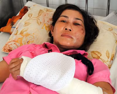 Chị Nguyễn Thị Tâm tại bệnh viện.