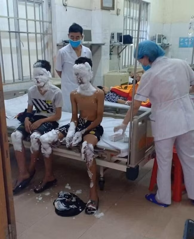 Nạn nhân của pháo nổ tự chế. Nạn nhân của pháo nổ tự chế.