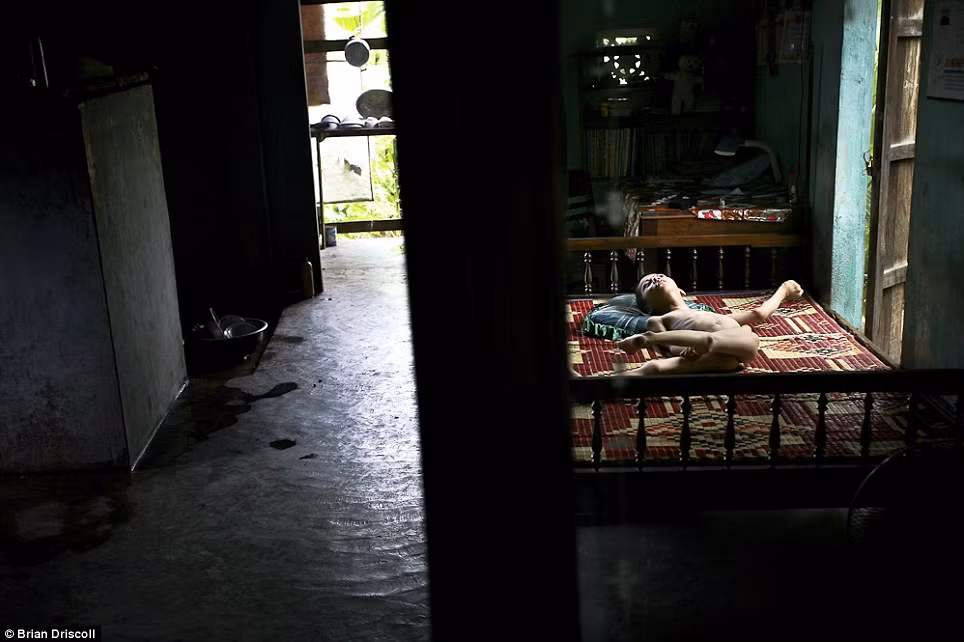 Nguyễn Quang, 11 tuổi, trên giường của mình ở nhà ở huyện Kim Động, Hải Phòng