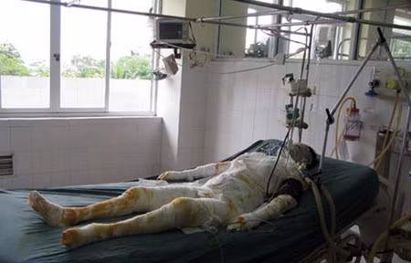 Nạn nhân đang cấp cứu tại bệnh viện