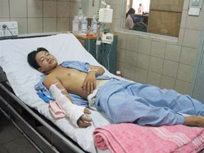 Bệnh nhân bị rắn cắn điều trị tại Trung tâm Chống độc, Bệnh viện Bạch Mai