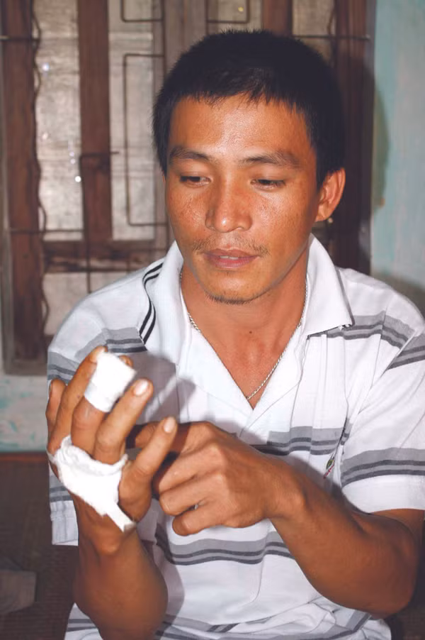 Anh Lý và vết thương