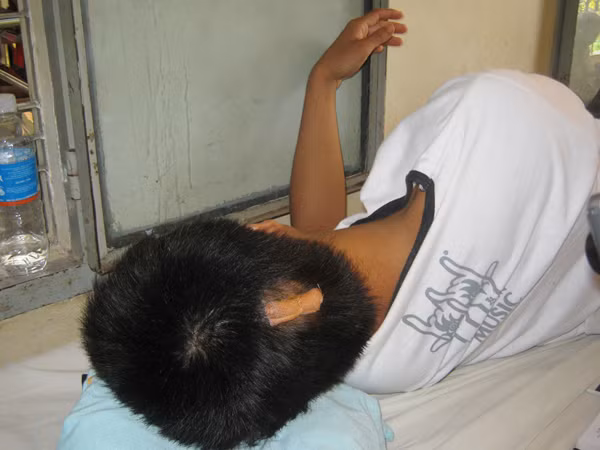 Anh Phước với vết thương do bị đánh ở đầu. Anh Phước với vết thương do bị đánh ở đầu