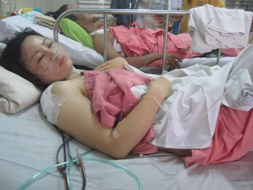 Điều dưỡng Nguyễn Thị Sáu đang điều trị vết thương tại Bệnh viện Chợ Rẫy