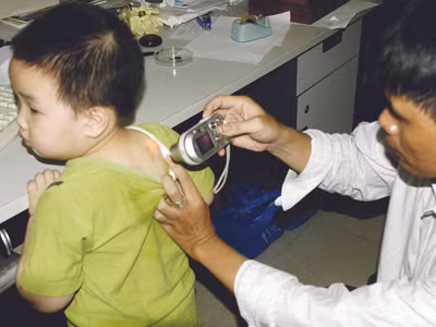 Bọ xít ở Việt Nam có dấu hiệu thích nghi với người và chủ động đốt người chứ không phải “ngẫu nhiên”. Ảnh: Phạm Yên