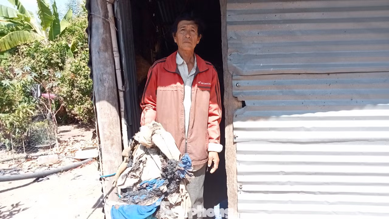 Ông Bên bên đống quần áo bị cháy do hiện tượng "tự cháy" gây ra Ông Bên bên đống quần áo bị cháy do hiện tượng "tự cháy" gây ra
