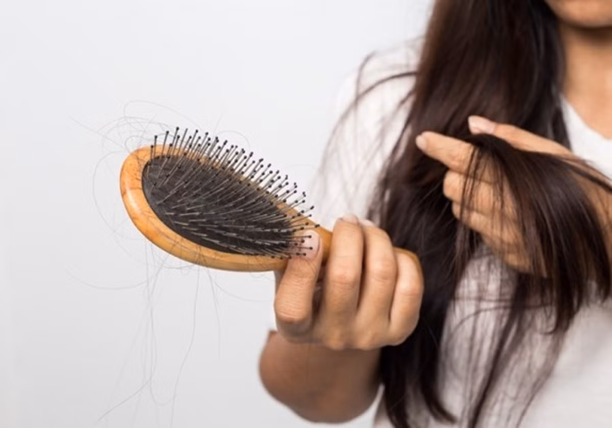 Một người bình thường mất khoảng 100 sợi tóc mỗi ngày, song điều này thường không gây ảnh hưởng đáng kể bởi vì tóc mới sẽ mọc lên song song. Một người bình thường mất khoảng 100 sợi tóc mỗi ngày, song điều này thường không gây ảnh hưởng đáng kể bởi vì tóc mới sẽ mọc lên song song.