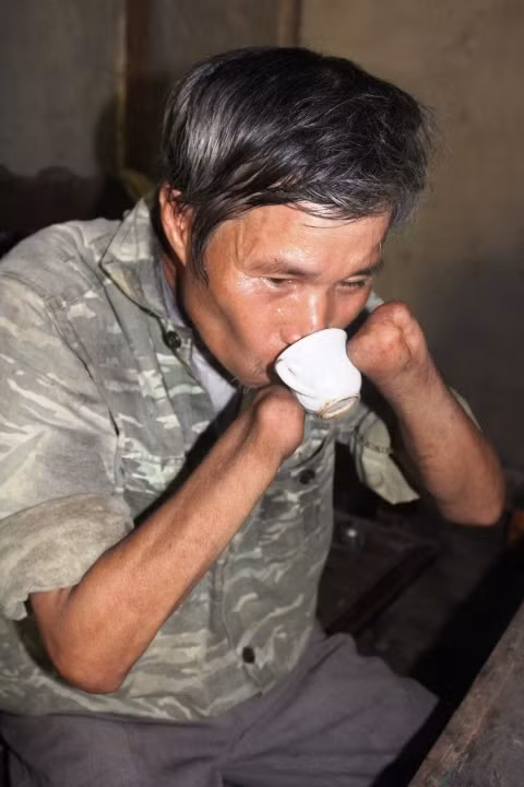 Trong số họ, có nhiều người đã từng tham gia đội quân tìm sắt vụn, khi chạm phải mìn phát nổ, một phần thân thể của họ đã không còn
