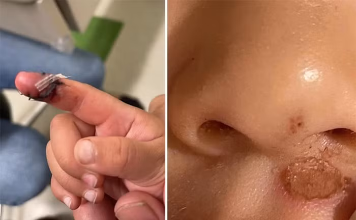 Trước đây, Trương Hằng công khai hình ảnh bị thương của hai con sau khi nhận hai đứa trẻ từ Trịnh Sảng. Anh hỏi nguyên nhân nhưng cô đưa ra nhiều lý do khác nhau. Ảnh: QQ. Trước đây, Trương Hằng công khai hình ảnh bị thương của hai con sau khi nhận hai đứa trẻ từ Trịnh Sảng. Anh hỏi nguyên nhân nhưng cô đưa ra nhiều lý do khác nhau. Ảnh: QQ.