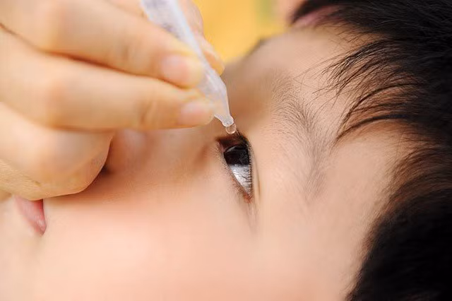 Nhớ nhỏ nước muối sinh lý thường xuyên để vệ sinh mắt