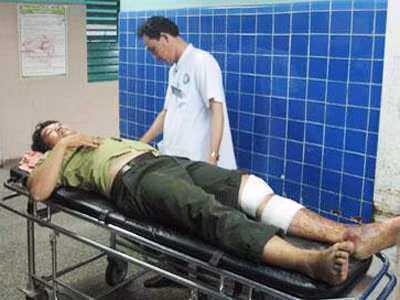Kiểm lâm viên Hoàng Văn Quế được cấp cứu và điều trị tại BV Hữu nghị Việt Nam- Cu Ba Đồng Hới Quảng Bình