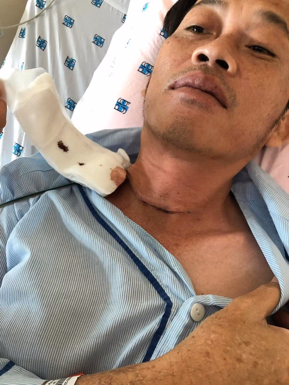 Hoài Linh cho biết anh phải thường xuyên vào thuốc sau cuộc phẫu thuật cắt tuyến giáp- ảnh L.T Hoài Linh cho biết anh phải thường xuyên vào thuốc sau cuộc phẫu thuật cắt tuyến giáp- ảnh L.T
