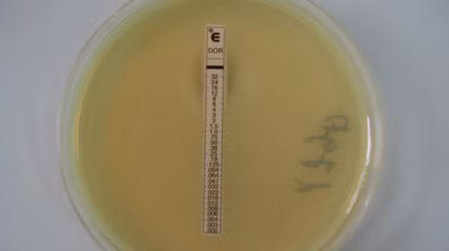 Vi khuẩn kháng thuốc nhóm carbapenem ở bệnh nhân điều trị tại Bệnh viện Bệnh nhiệt đới T.Ư . Ảnh tư liệu do bệnh viện cung cấp. (Tuổi Trẻ) Vi khuẩn kháng thuốc nhóm carbapenem ở bệnh nhân điều trị tại Bệnh viện Bệnh nhiệt đới T.Ư - h tư liệu do bệnh viện cung cấp