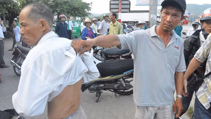 Ông Thường bị chém ngang lưng khi tham gia giải cứu xe ôm bị bắt làm con tin - Ảnh: Tấn Vũ (Tuổi Trẻ)