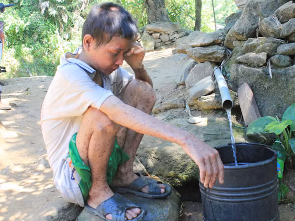Bệnh nhân Phạm Văn Trách dù sức khỏe rất yếu vẫn cố gắng lấy nước suối về sinh hoạt -Ảnh: PHÚC LONG