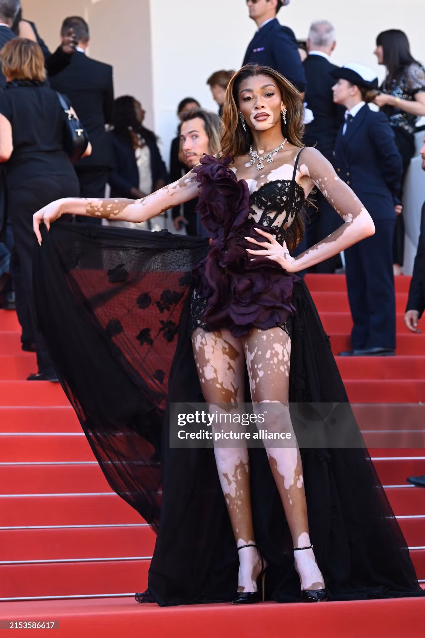 Siêu mẫu bạch biến Winnie Harlow cuốn hút trong thiết kế màu đen, khoe chân dài thon gọn.