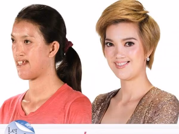 Phẫu thuật thẩm mỹ đã thay đổi số phận một người như thế nào? ảnh 3 Phẫu thuật thẩm mỹ đã thay đổi số phận một người như thế nào? ảnh 3