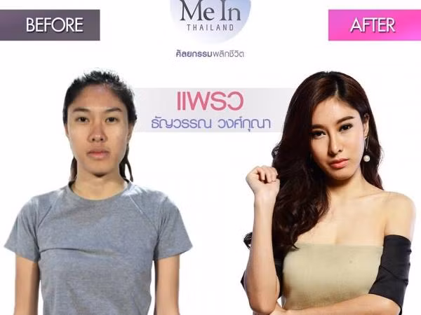 Phẫu thuật thẩm mỹ đã thay đổi số phận một người như thế nào? ảnh 2 Phẫu thuật thẩm mỹ đã thay đổi số phận một người như thế nào? ảnh 2
