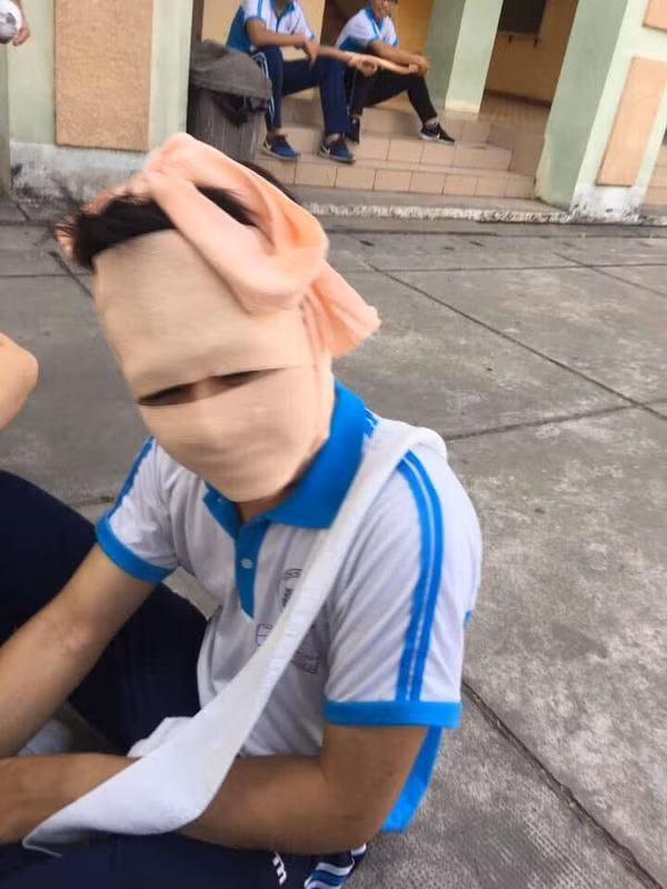 Băng bó kín cả mặt, nhìn thôi đã thấy khó thở.
