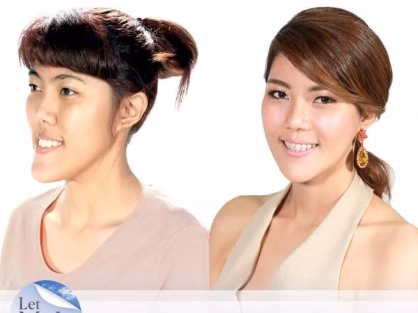 Phẫu thuật thẩm mỹ đã thay đổi số phận một người như thế nào? ảnh 4