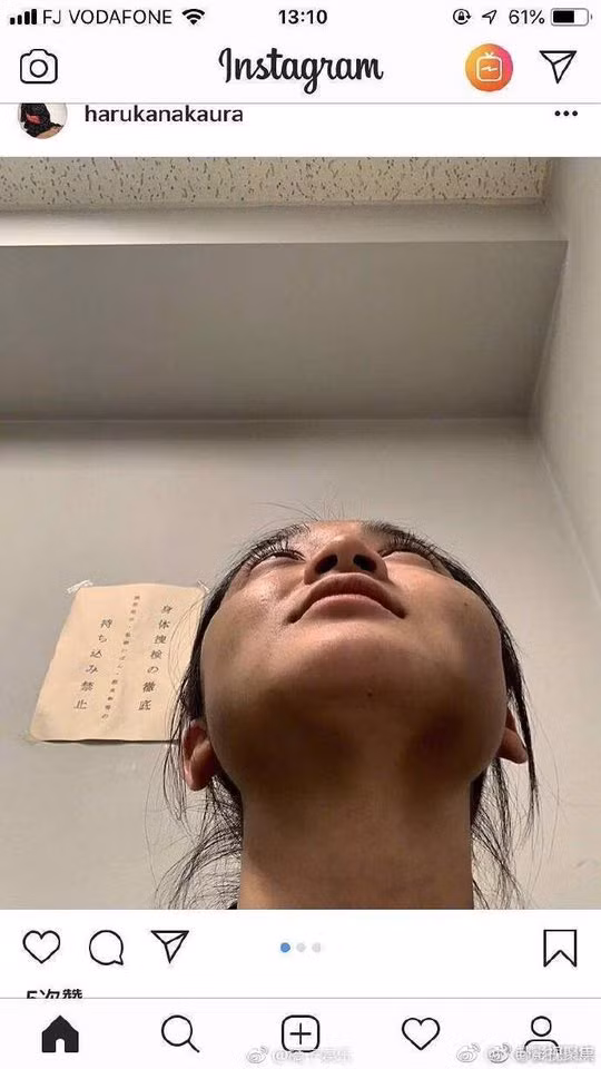 Cơ thể đầy vết thương của Haruka Nakaura.