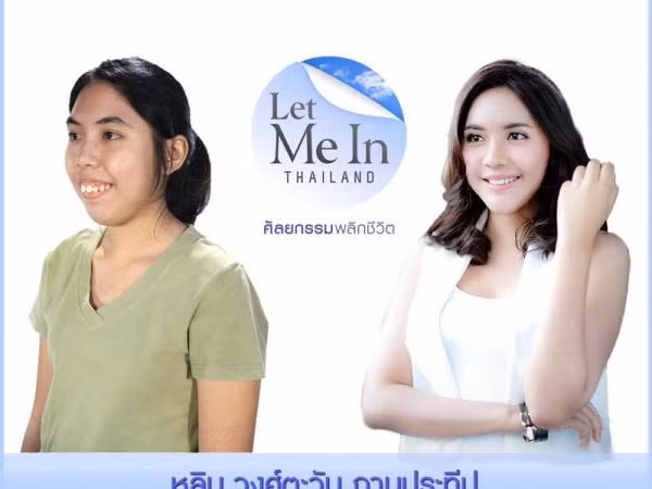 Phẫu thuật thẩm mỹ đã thay đổi số phận một người như thế nào? ảnh 1 Phẫu thuật thẩm mỹ đã thay đổi số phận một người như thế nào? ảnh 1