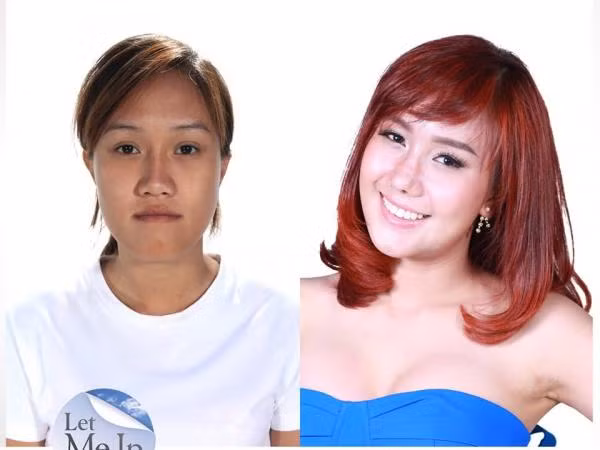 Phẫu thuật thẩm mỹ đã thay đổi số phận một người như thế nào? ảnh 13 Phẫu thuật thẩm mỹ đã thay đổi số phận một người như thế nào? ảnh 13