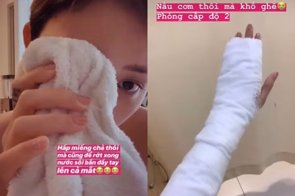 Mặc dù vết thương không quá nặng, tuy nhiên câu chuyện hi hữu này như một lời nhắc nhở khán giả nên cẩn trọng mỗi khi xuống bếp.
