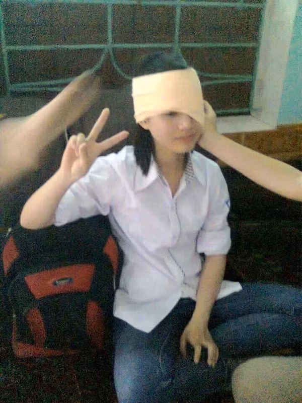 Có vẻ như đây là kiểu băng bó trông ổn nhất.