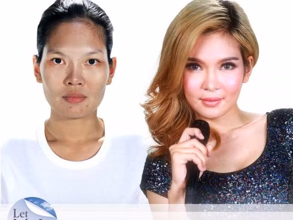 Phẫu thuật thẩm mỹ đã thay đổi số phận một người như thế nào? ảnh 7 Phẫu thuật thẩm mỹ đã thay đổi số phận một người như thế nào? ảnh 7