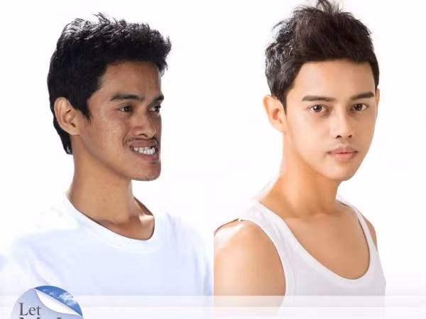 Phẫu thuật thẩm mỹ đã thay đổi số phận một người như thế nào? ảnh 10 Phẫu thuật thẩm mỹ đã thay đổi số phận một người như thế nào? ảnh 10