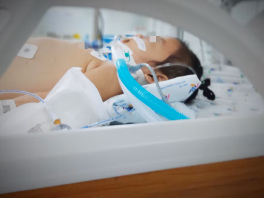 Bé gái nhập viện trong tình trạng nguy kịch phải hỗ trợ thở máy, điều trị tích cực