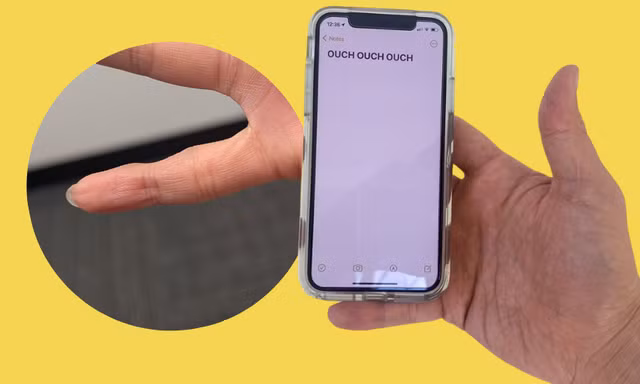 Hội chứng "ngón út smartphone" là gì, có phải chỉ xảy ra ở Gen Z như lời đồn?