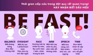 Đột quỵ và những dấu hiệu được báo trước
