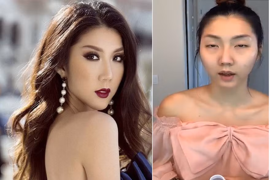 'Hốt hoảng' trước gương mặt khác lạ khó tin của siêu mẫu Ngọc Quyên, thực hư ra sao? 