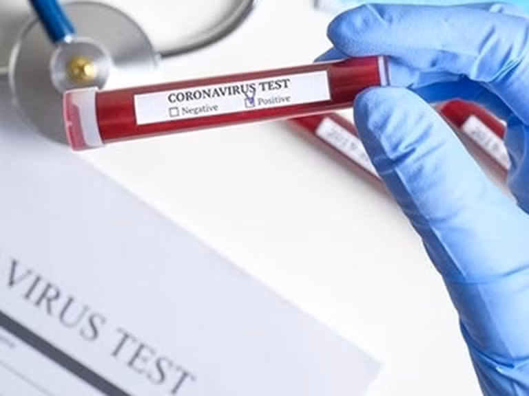 Nghiên cứu mới về sự tấn công của virus corona đối với người mắc COVID - 19 ảnh 2
