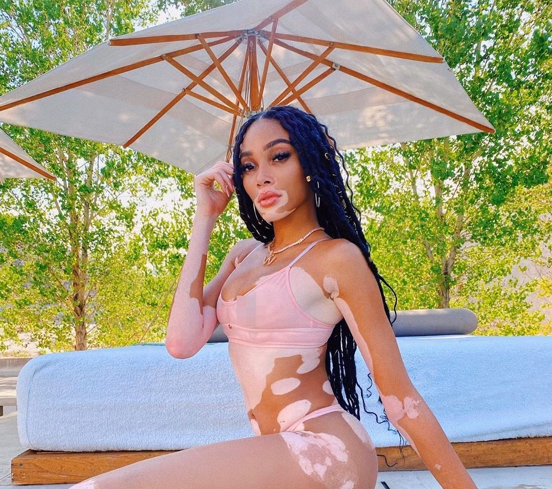 Winnie Harlow thư giãn bên hồ bơi với bikini nhỏ xíu ảnh 3
