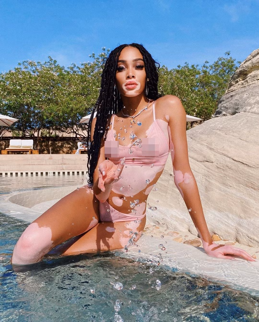 Winnie Harlow thư giãn bên hồ bơi với bikini nhỏ xíu ảnh 2