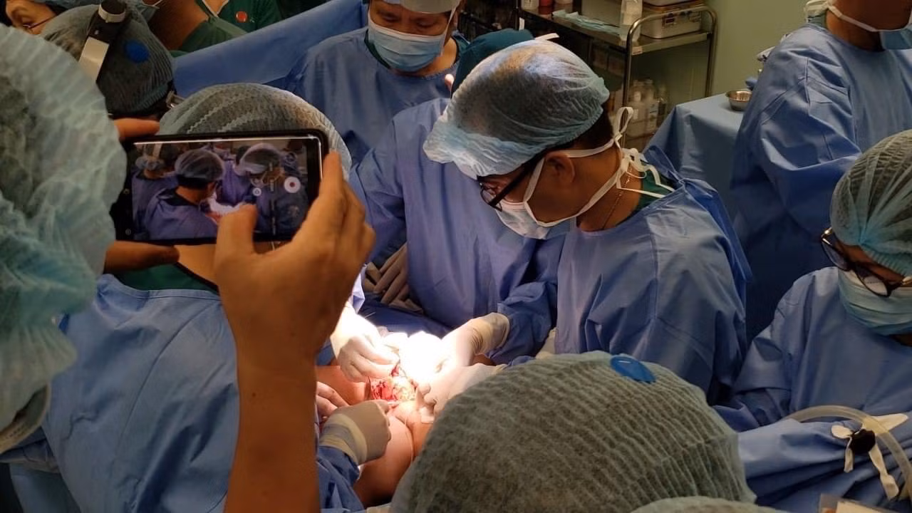 Đã tách thành công hai bé Trúc Nhi - Diệu Nhi dính nhau ảnh 4