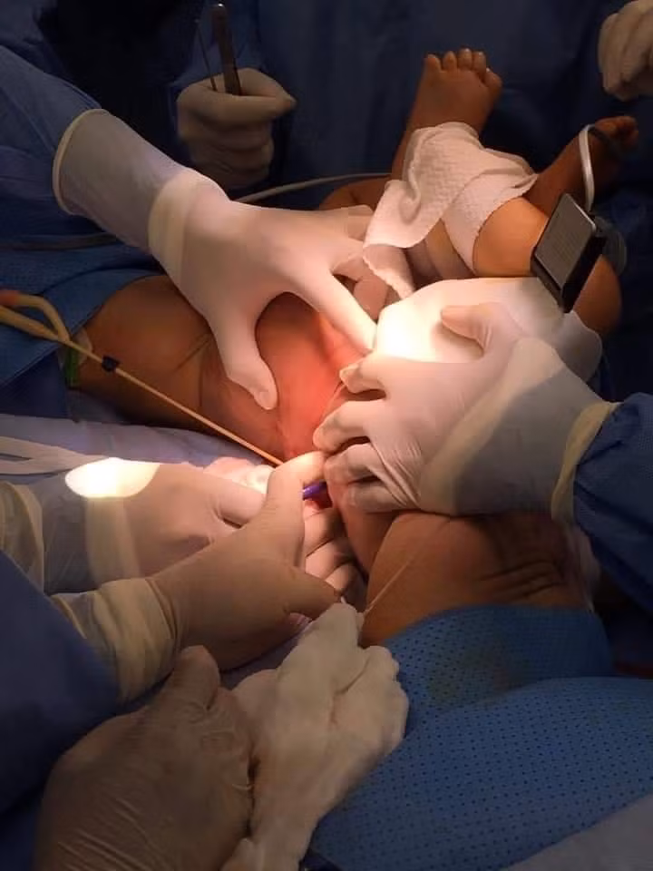 Đã tách thành công hai bé Trúc Nhi - Diệu Nhi dính nhau ảnh 3