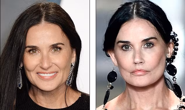Minh tinh Demi Moore gợi cảm diễn thời trang, mặt khác lạ nghi phẫu thuật thẩm mỹ ảnh 6