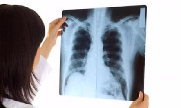 Dấu hiệu trẻ bị viêm não, cha mẹ cho đến viện khám ngay kẻo ‘muộn’ ảnh 2