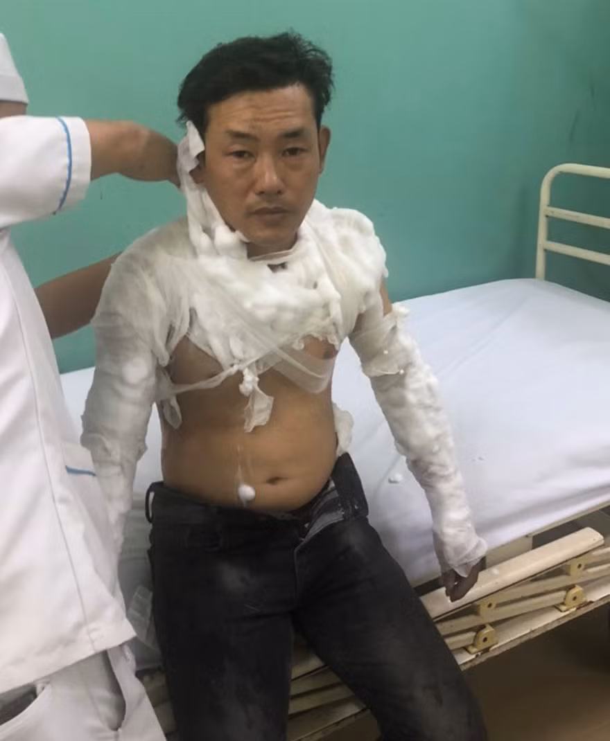 Vụ 9X tẩm xăng lên người để cướp ngân hàng: Nhân viên bí mật nhấn chuông báo động ảnh 1