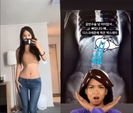 Netizen Hàn tìm thấy nhân vật showbiz có vòng eo còn “siêu thực” hơn cả Seo Ye Ji ảnh 5