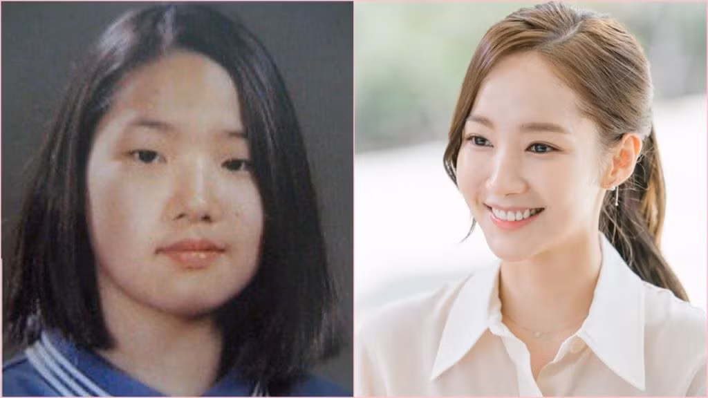 Sự thật gây sốc về bức ảnh của “Nữ hoàng dao kéo” Park Min Young trước khi thẩm mỹ ảnh 2